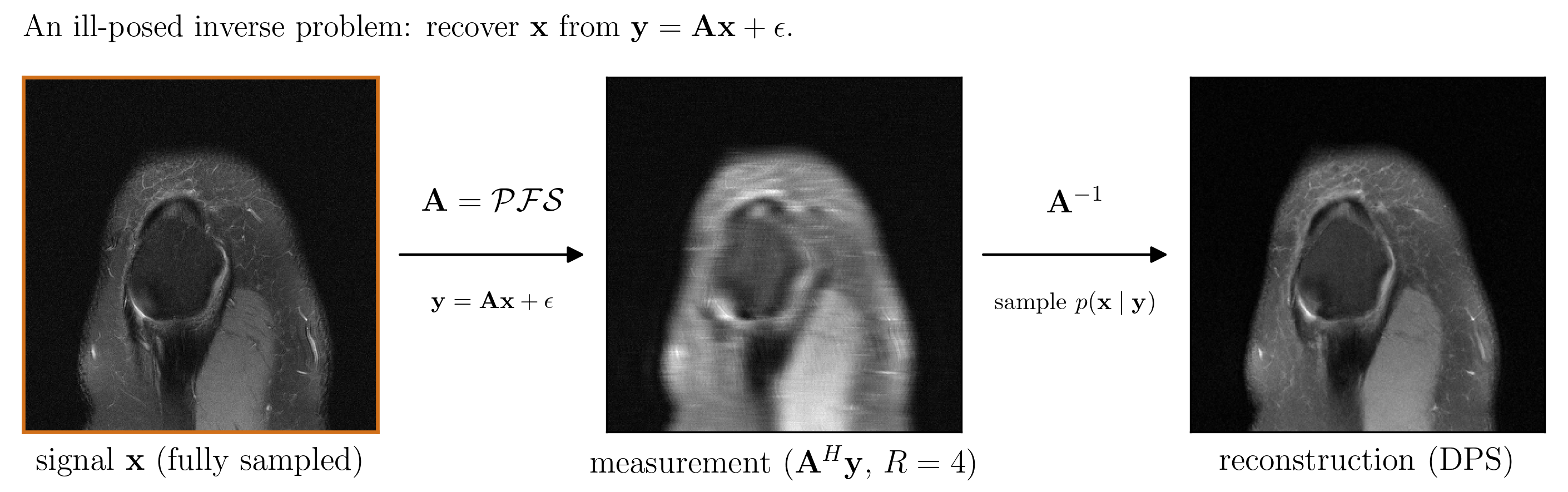 An accelerated MRI inverse problem: a fully sampled knee image is undersampled into an aliased measurement, then reconstructed by posterior sampling.