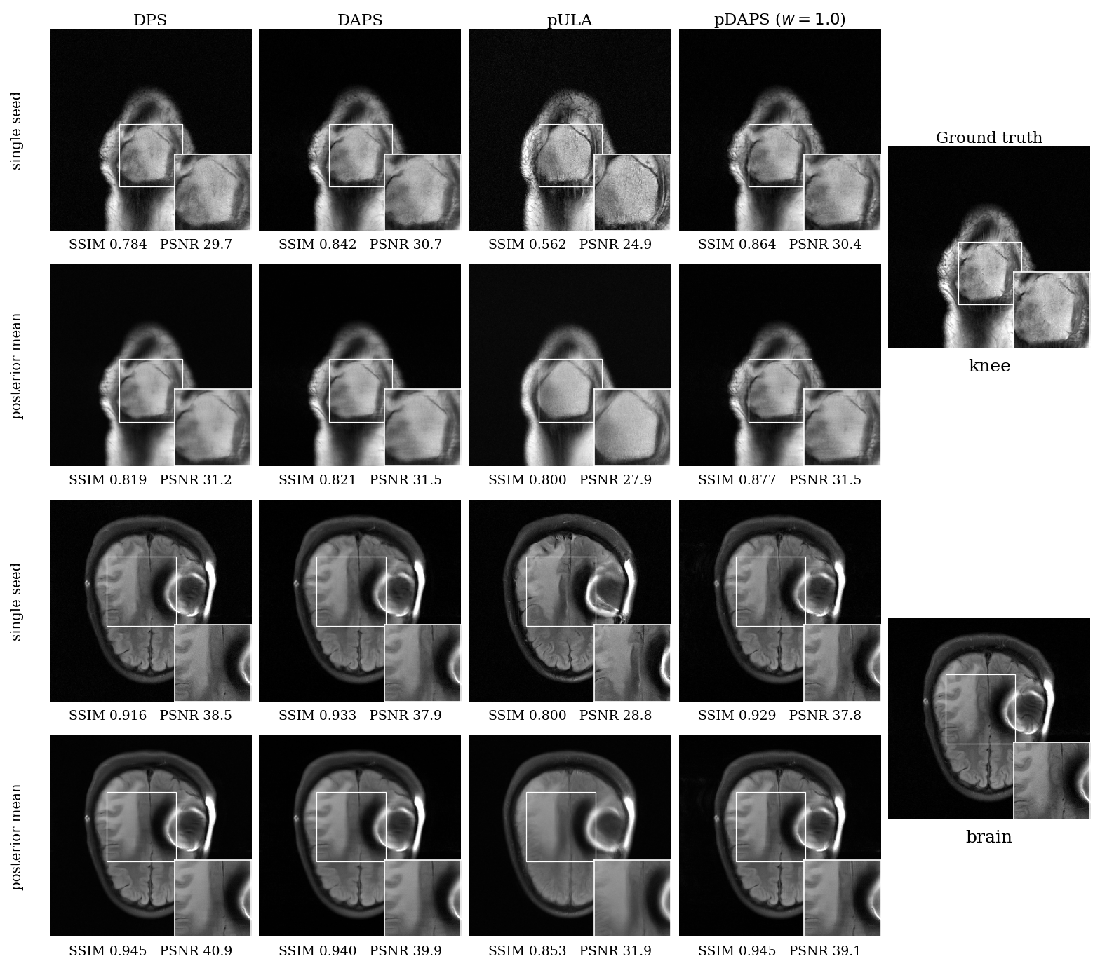 Grid of knee and brain MRI reconstructions at 4× acceleration comparing DPS, DAPS, pULA, and pDAPS against ground truth, with single-seed samples, 8-seed posterior means, magnified insets, and per-panel SSIM and PSNR.