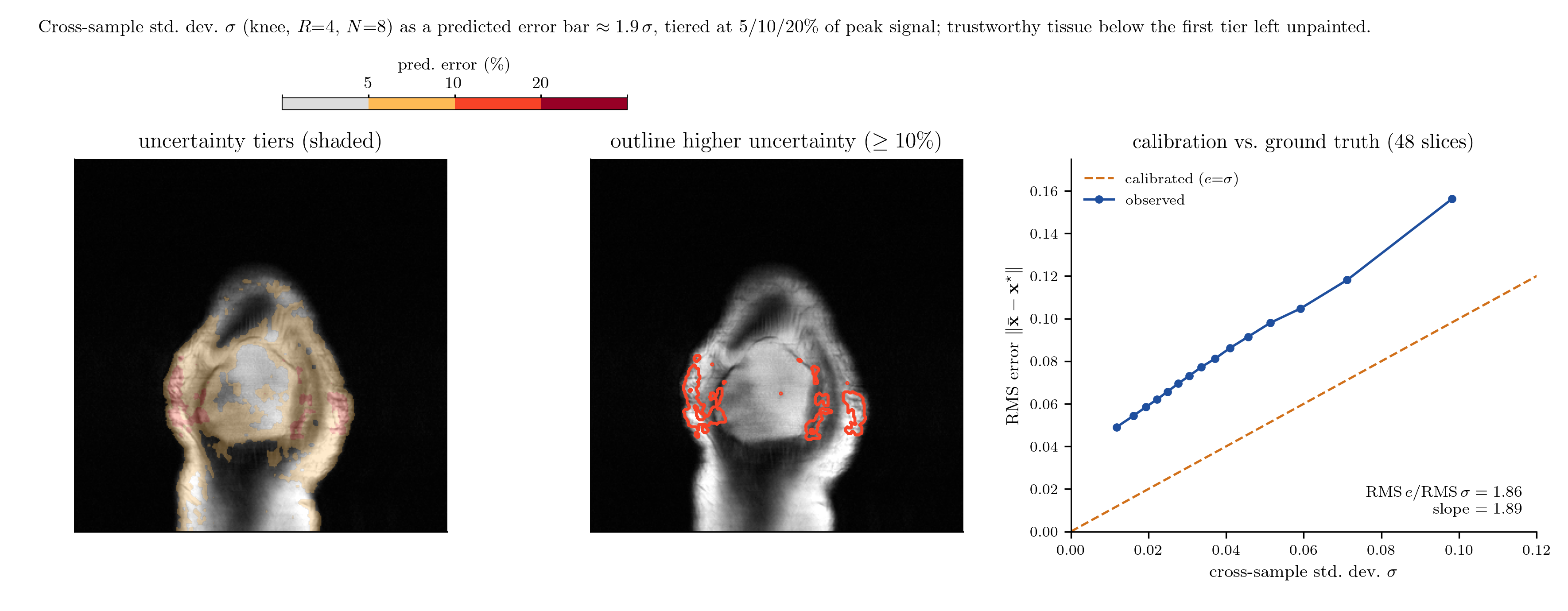 pDAPS knee MRI uncertainty tiers, high-uncertainty outlines, and a calibration plot showing observed error above the uncalibrated identity line.